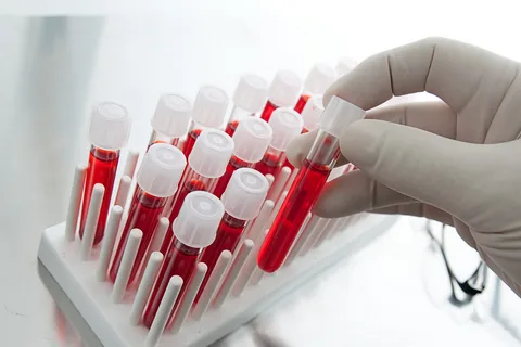 blood analysis Melbourne, live blood analysis Melbourne